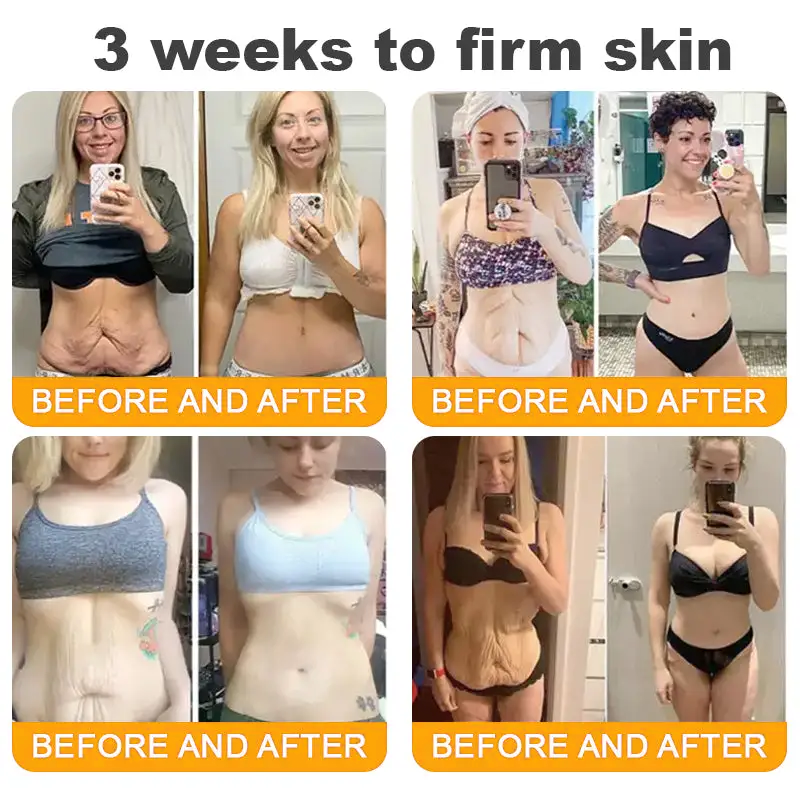 ✨TLOPA® Bee Venom Repair Radiance Cream | Unlock Smooth Skin, Fight Sagging 🎁 Lightweight Daily Care, Limited-Time 70% OFF🎊