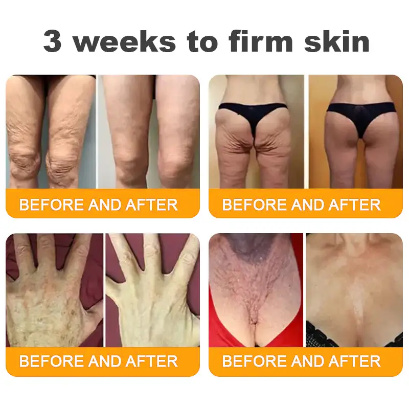 ✨TLOPA® Bee Venom Repair Radiance Cream | Unlock Smooth Skin, Fight Sagging 🎁 Lightweight Daily Care, Limited-Time 70% OFF🎊