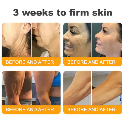 ✨TLOPA® Bee Venom Repair Radiance Cream | Unlock Smooth Skin, Fight Sagging 🎁 Lightweight Daily Care, Limited-Time 70% OFF🎊